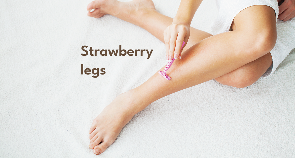 keratosis pilaris, strawberry legs, reasons for strawberry legs, how to prevent strawberry skin, bodycare